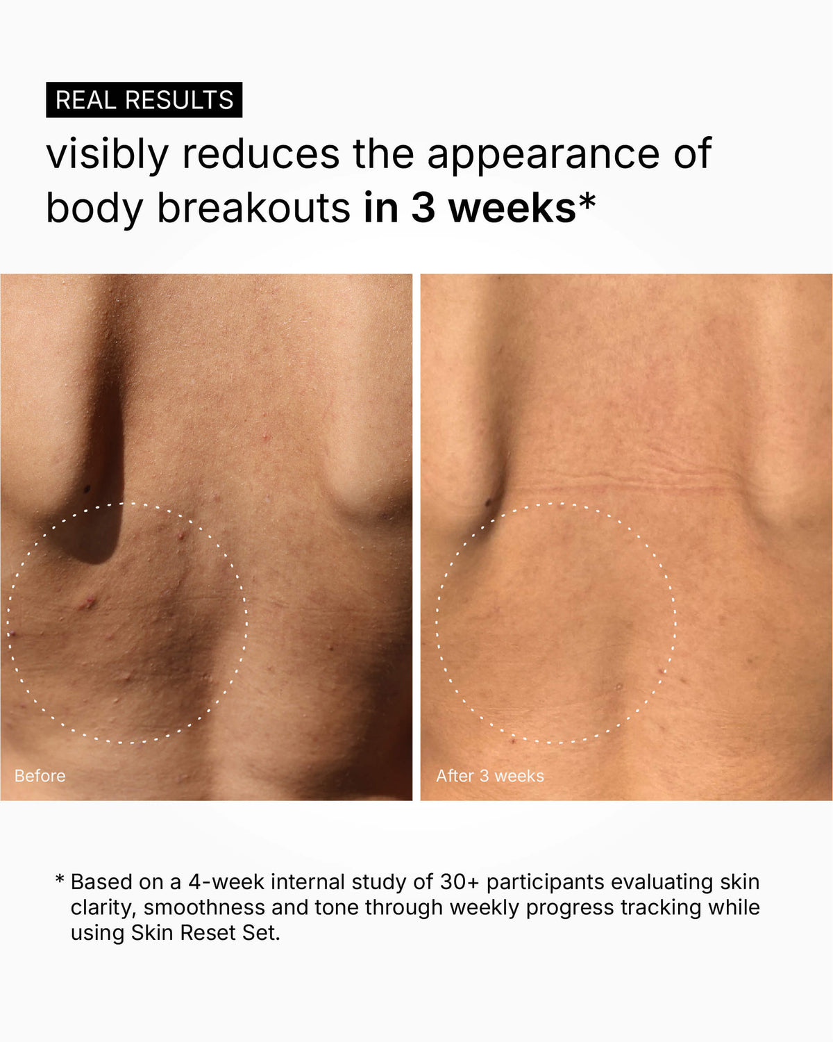 Skin Reset Set - Vollständige Körperroutine