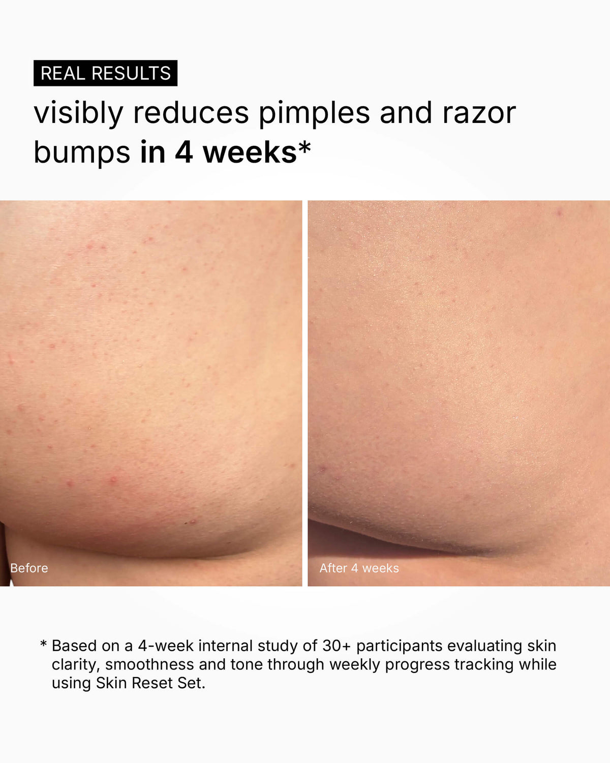 Skin Reset Set - Full Body Routine