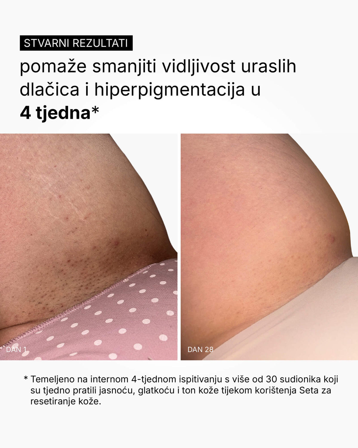 Skin Reset Set - Vollständige Körperroutine