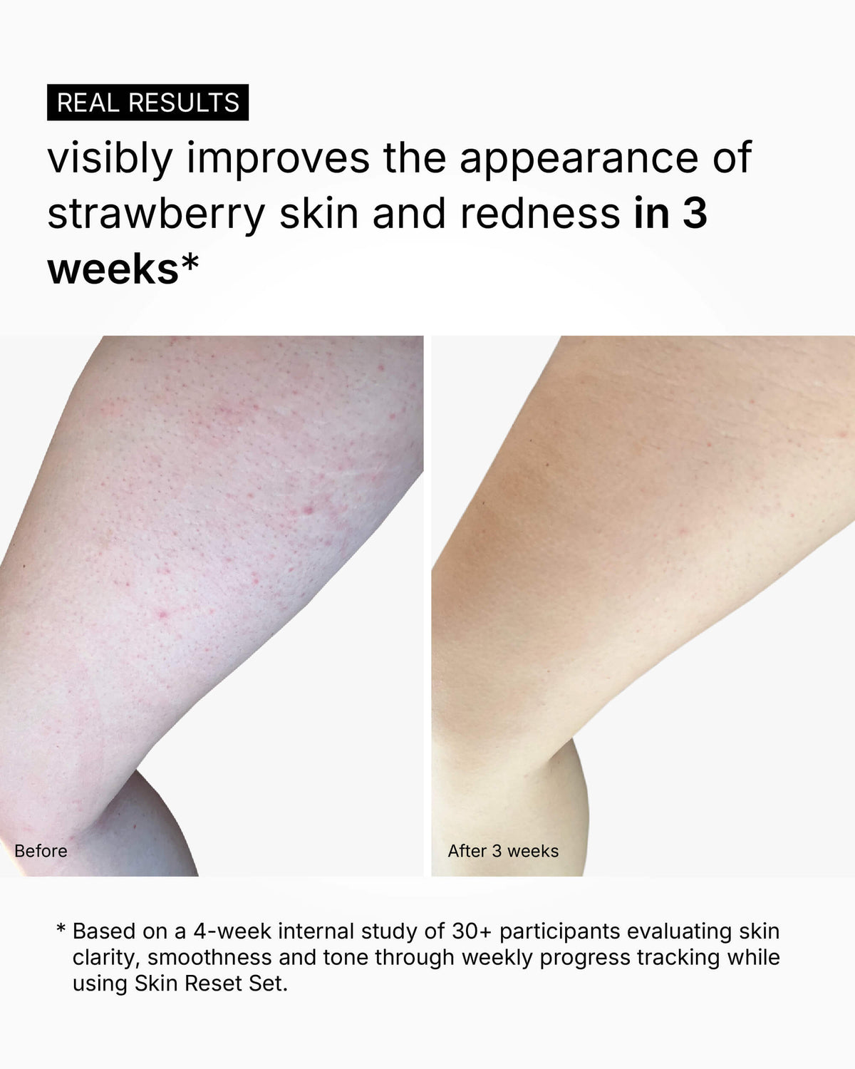 Skin Reset Set - Full Body Routine