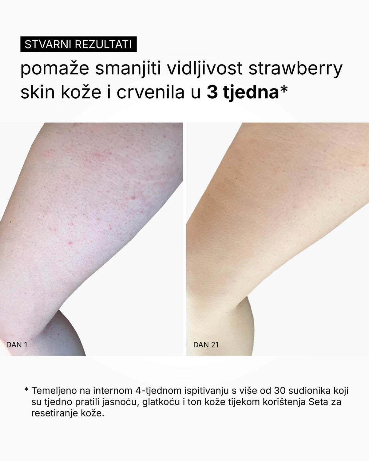 Skin Reset Set - Vollständige Körperroutine
