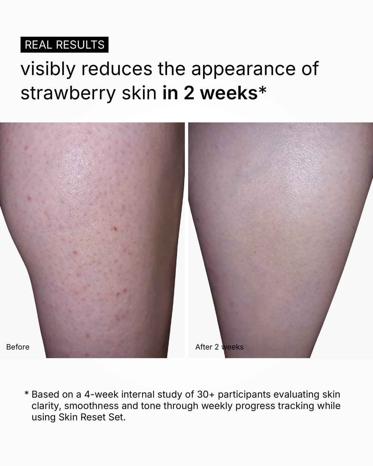 Skin Reset Set - Full Body Routine