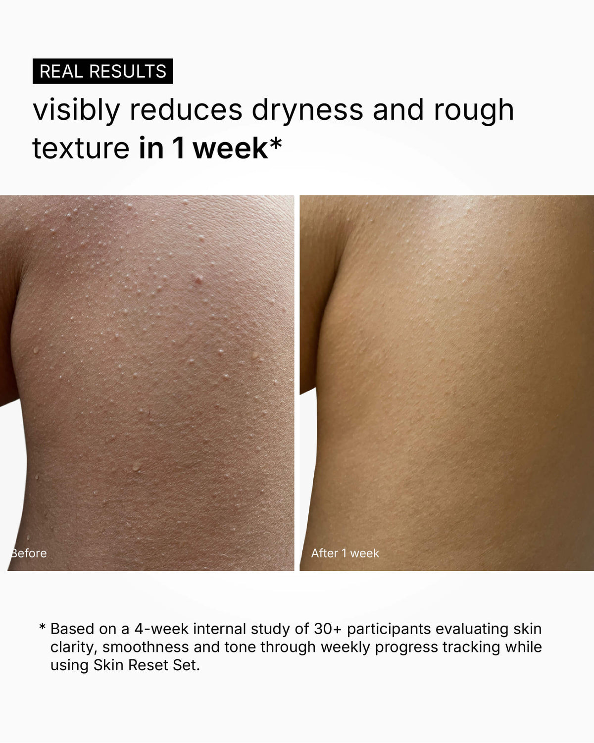 Skin Reset Set - Full Body Routine